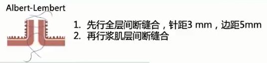 直肠吻合器钉子什么样结直肠手术缝合技术和缝线选择_https://www.jmylbn.com_新闻资讯_第9张