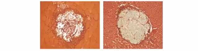 直肠吻合器钉子什么样结直肠手术缝合技术和缝线选择_https://www.jmylbn.com_新闻资讯_第24张