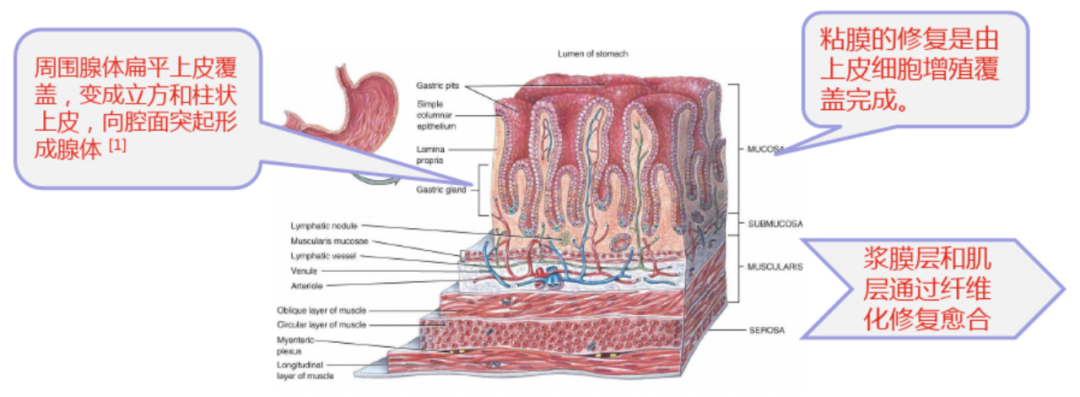 直肠吻合器钉子什么样结直肠手术缝合技术和缝线选择_https://www.jmylbn.com_新闻资讯_第4张