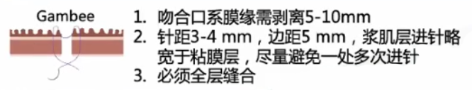 直肠吻合器钉子什么样结直肠手术缝合技术和缝线选择_https://www.jmylbn.com_新闻资讯_第10张