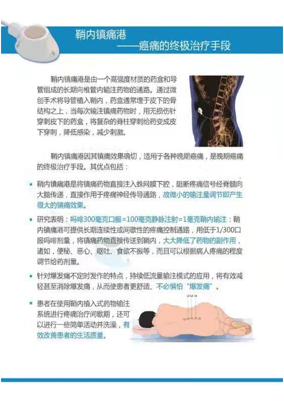 为什么要用泵打针医疗技术 ｜ “镇痛泵体内植入术”还“癌痛患者一个无痛人生”！_https://www.jmylbn.com_新闻资讯_第5张