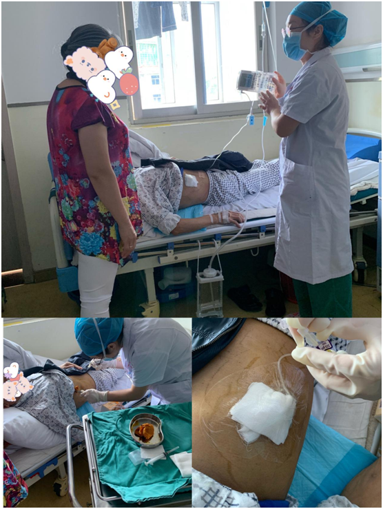 为什么要用泵打针医疗技术 ｜ “镇痛泵体内植入术”还“癌痛患者一个无痛人生”！_https://www.jmylbn.com_新闻资讯_第4张