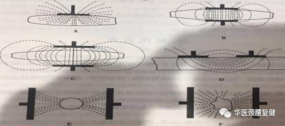 体外短波电容为什么要做万物皆可超短波？_https://www.jmylbn.com_新闻资讯_第10张