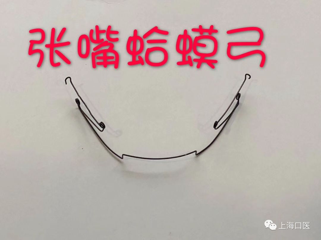 武氏张嘴蛤蟆弓 武广增正畸工作室 迈植education 微信公众号文章阅读 Wemp