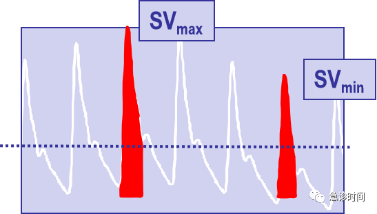 GE病人列表怎么删除picco--血流动力学指标解读--前负荷参数解读_https://www.jmylbn.com_新闻资讯_第6张