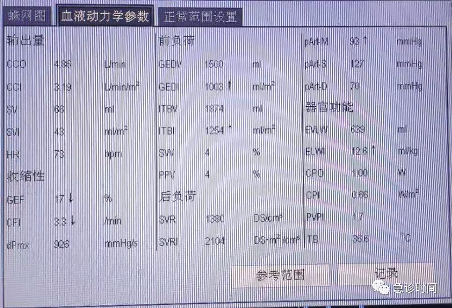 GE病人列表怎么删除picco--血流动力学指标解读--前负荷参数解读_https://www.jmylbn.com_新闻资讯_第5张
