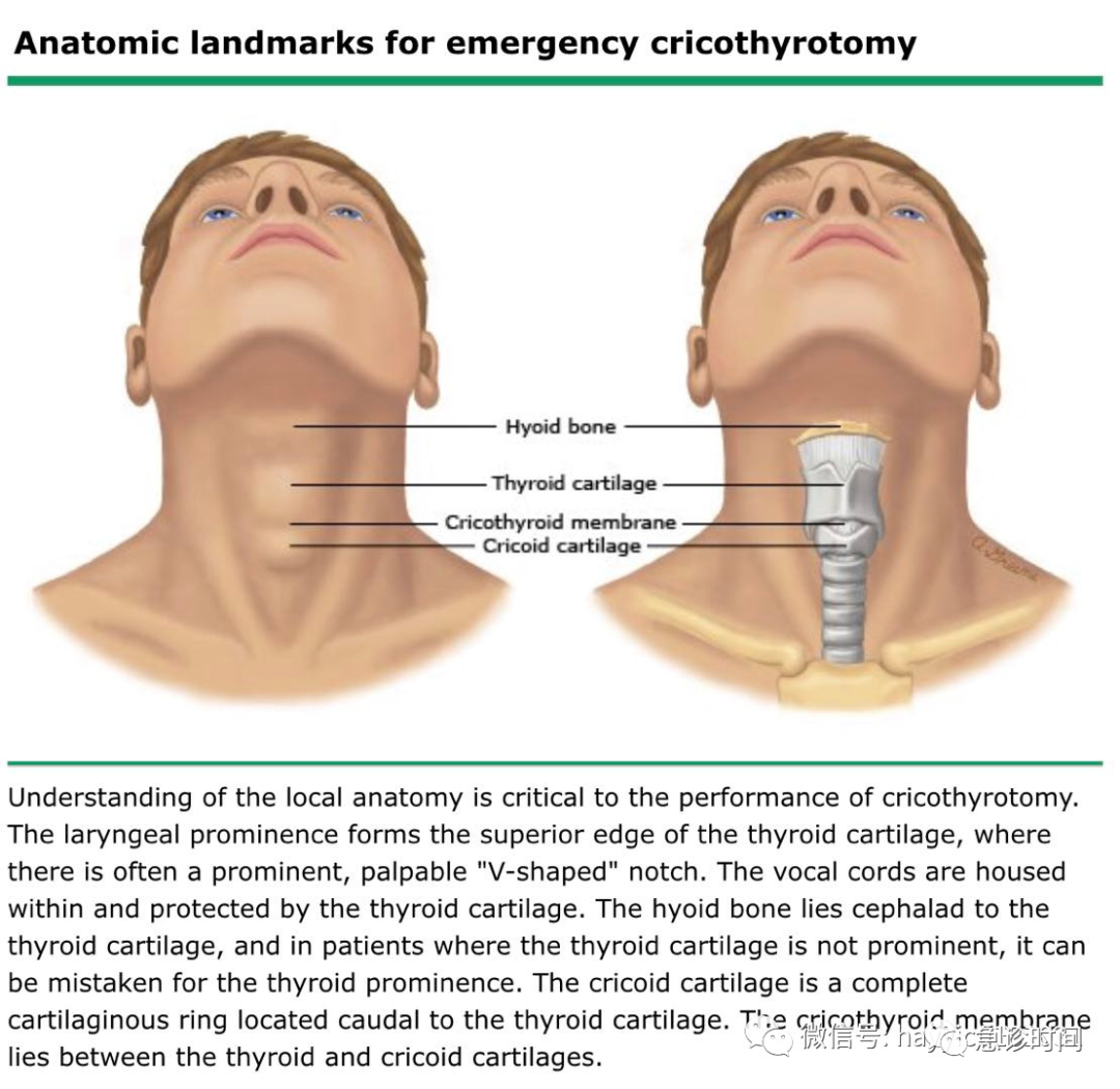 急诊环甲膜切开术理论操作