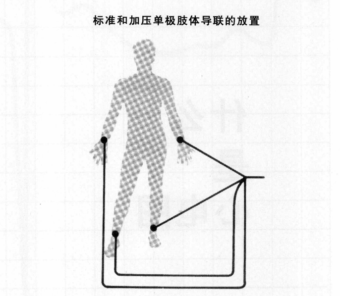 什么叫心电电极跟我学习心电图----心电图的形成（1）-上海聚慕医疗器械有限公司