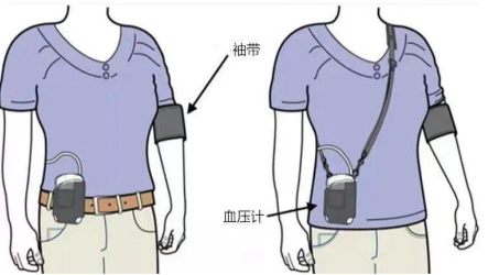 abpm血压怎么看【科普】让我们一起了解动态血压监测（ABPM）_https://www.jmylbn.com_新闻资讯_第3张
