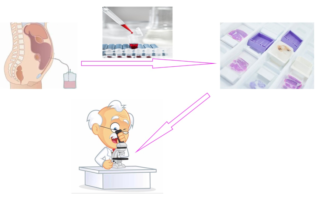 什么是病理蜡块晚期肿瘤诊断利器 —— 病理科细胞蜡块技术_https://www.jmylbn.com_新闻资讯_第3张