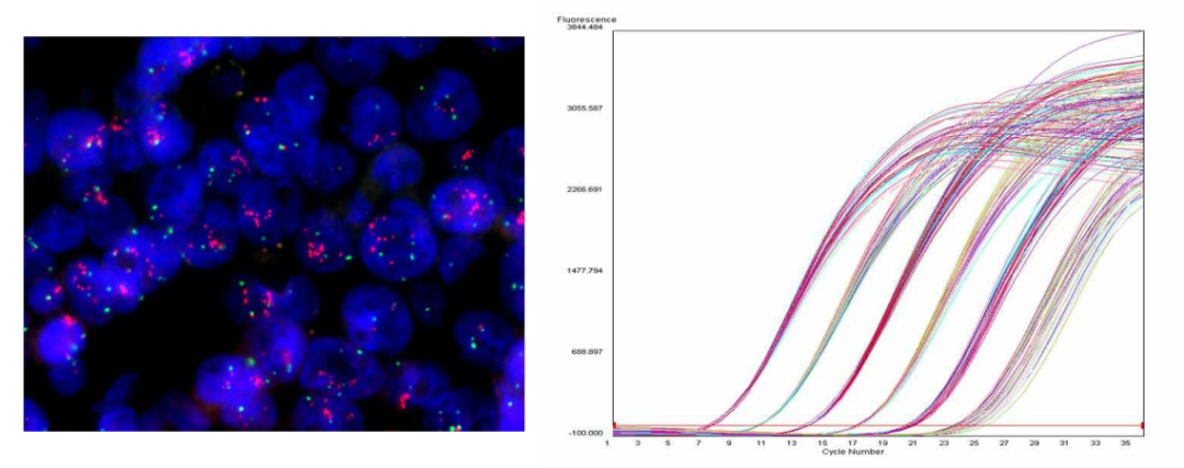 什么是病理蜡块晚期肿瘤诊断利器 —— 病理科细胞蜡块技术_https://www.jmylbn.com_新闻资讯_第5张