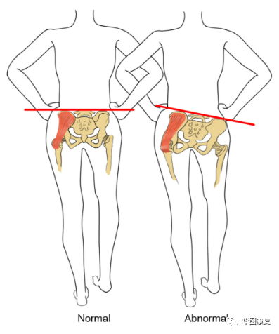 步态分析上曲线怎么解读步态分析，认识我们的步态和异常步态_https://www.jmylbn.com_新闻资讯_第15张