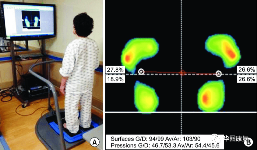 步态分析上曲线怎么解读步态分析，认识我们的步态和异常步态_https://www.jmylbn.com_新闻资讯_第6张