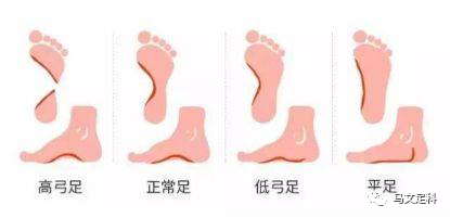 鞋跟太高怎么办 马文足科 宜春新闻