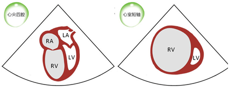 什么叫超声容积探头围手术期经食管超声心动图监测操作的专家共识（可下载）_https://www.jmylbn.com_新闻资讯_第68张