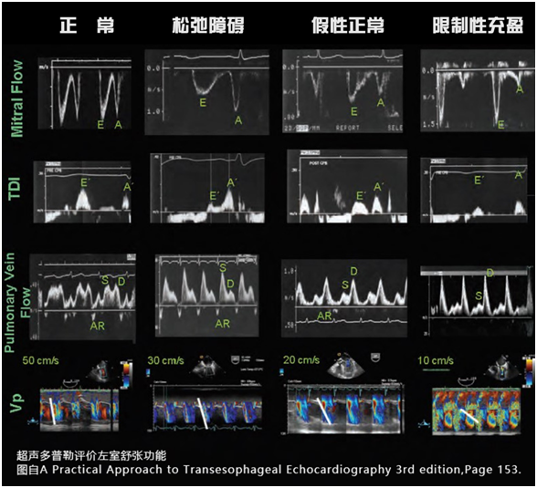 什么叫超声容积探头围手术期经食管超声心动图监测操作的专家共识（可下载）_https://www.jmylbn.com_新闻资讯_第51张