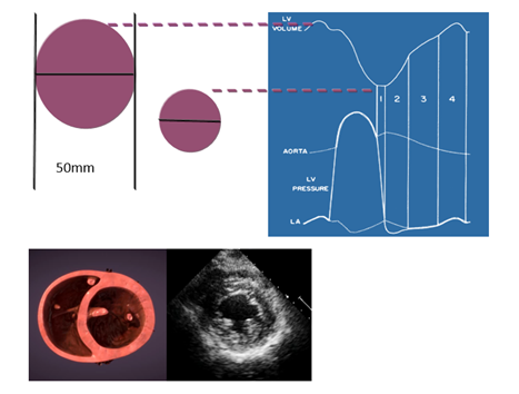 什么叫超声容积探头围手术期经食管超声心动图监测操作的专家共识（可下载）_https://www.jmylbn.com_新闻资讯_第46张