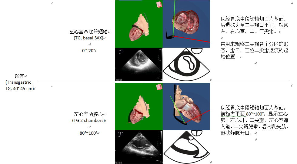 什么叫超声容积探头围手术期经食管超声心动图监测操作的专家共识（可下载）_https://www.jmylbn.com_新闻资讯_第34张