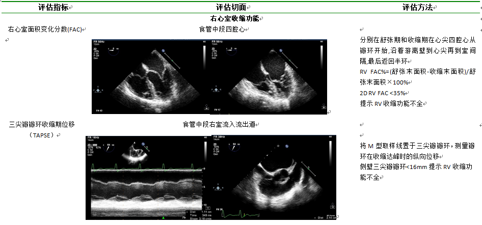 什么叫超声容积探头围手术期经食管超声心动图监测操作的专家共识（可下载）_https://www.jmylbn.com_新闻资讯_第55张