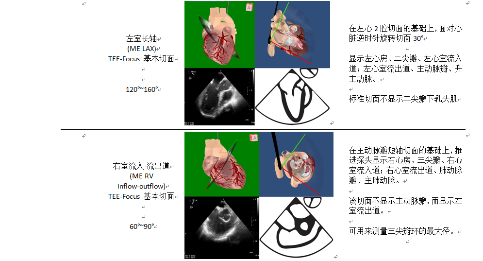 什么叫超声容积探头围手术期经食管超声心动图监测操作的专家共识（可下载）_https://www.jmylbn.com_新闻资讯_第31张