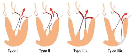 什么叫超声容积探头围手术期经食管超声心动图监测操作的专家共识（可下载）_https://www.jmylbn.com_新闻资讯_第79张