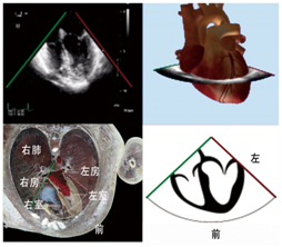 什么叫超声容积探头围手术期经食管超声心动图监测操作的专家共识（可下载）_https://www.jmylbn.com_新闻资讯_第23张