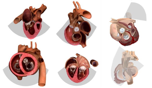 什么叫超声容积探头围手术期经食管超声心动图监测操作的专家共识（可下载）_https://www.jmylbn.com_新闻资讯_第39张