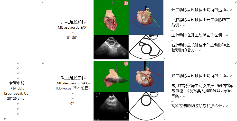 什么叫超声容积探头围手术期经食管超声心动图监测操作的专家共识（可下载）_https://www.jmylbn.com_新闻资讯_第28张