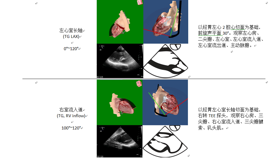 什么叫超声容积探头围手术期经食管超声心动图监测操作的专家共识（可下载）_https://www.jmylbn.com_新闻资讯_第35张