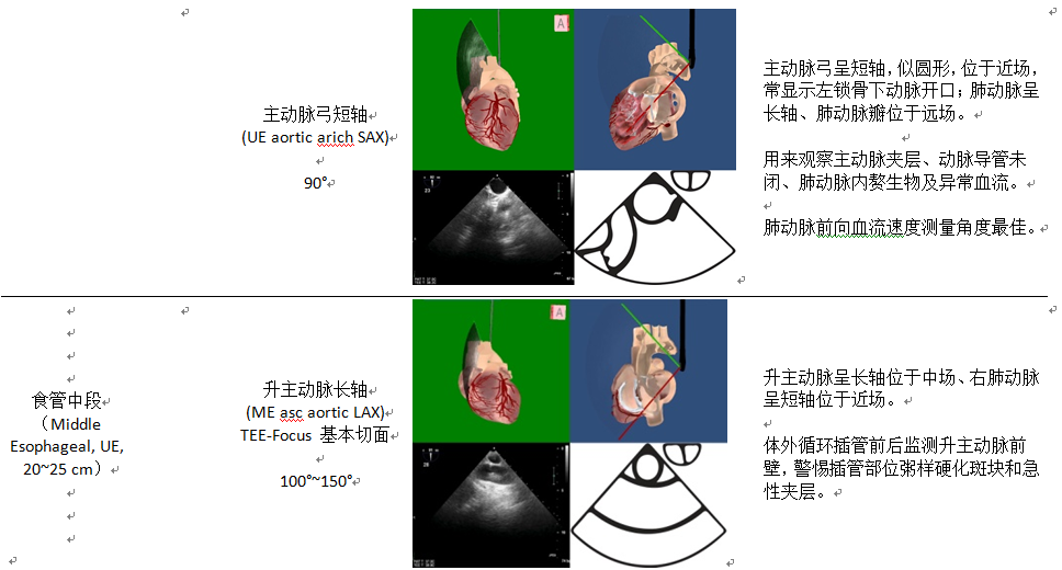 什么叫超声容积探头围手术期经食管超声心动图监测操作的专家共识（可下载）_https://www.jmylbn.com_新闻资讯_第27张