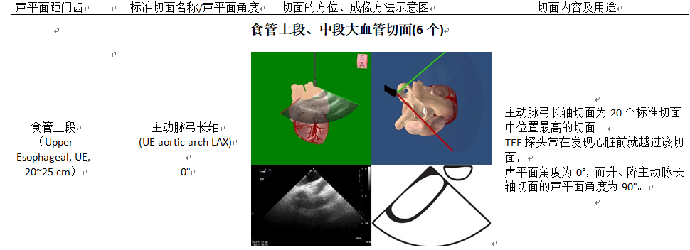 什么叫超声容积探头围手术期经食管超声心动图监测操作的专家共识（可下载）_https://www.jmylbn.com_新闻资讯_第26张
