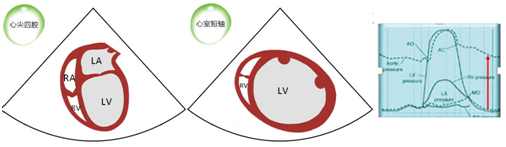 什么叫超声容积探头围手术期经食管超声心动图监测操作的专家共识（可下载）_https://www.jmylbn.com_新闻资讯_第66张