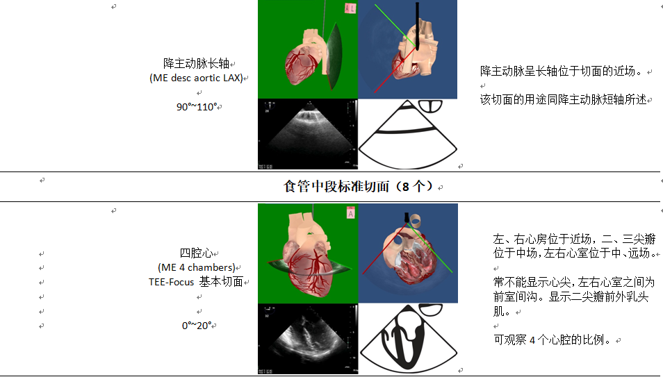 什么叫超声容积探头围手术期经食管超声心动图监测操作的专家共识（可下载）_https://www.jmylbn.com_新闻资讯_第29张