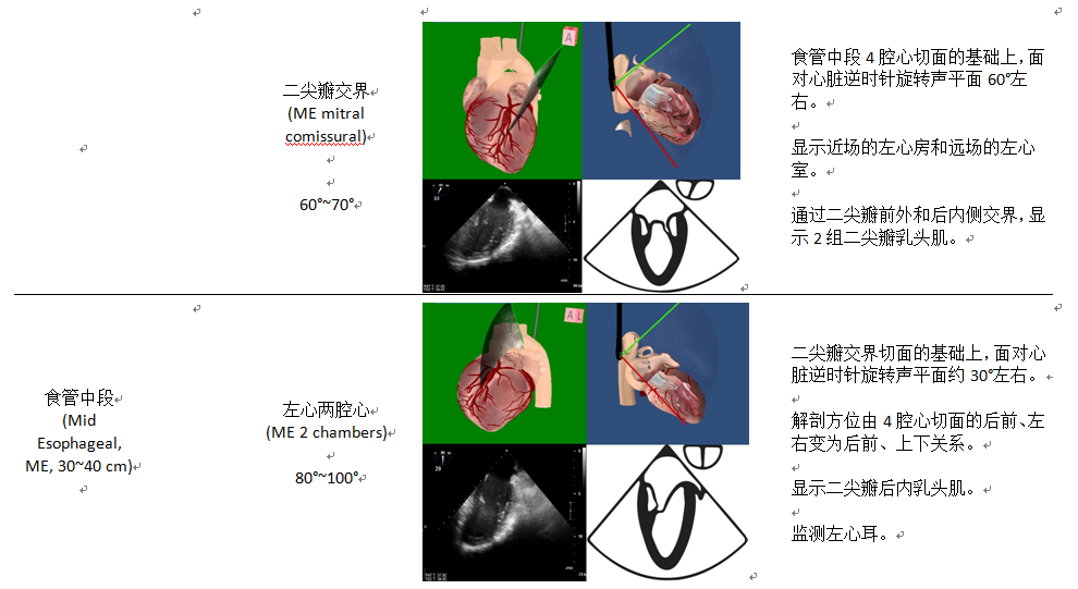 什么叫超声容积探头围手术期经食管超声心动图监测操作的专家共识（可下载）_https://www.jmylbn.com_新闻资讯_第30张
