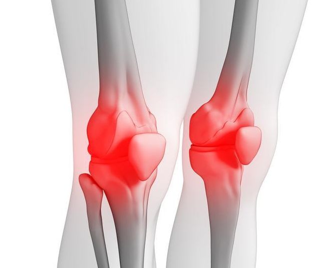 积液消了，滑膜炎自然就好了!这个土方，专消积液，最快5天！