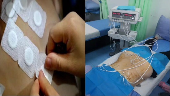 医讯怎么用【医讯】女性尿失禁不用愁，一根吊带解烦忧_https://www.jmylbn.com_新闻资讯_第4张