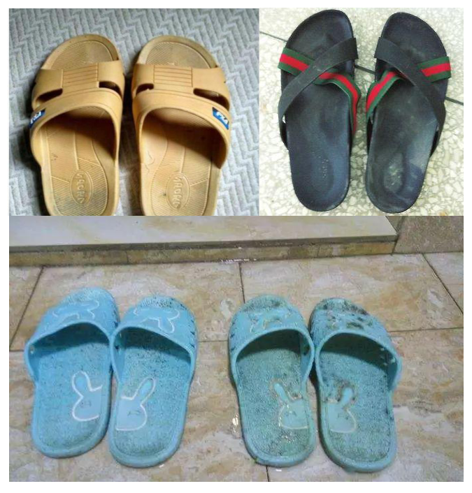 什么是医用气垫圈“气垫椰子鞋”火了！大半个娱乐圈都在穿的神仙拖，一脚踩进云朵里！全掌按摩，踩屎感爆棚，防滑耐磨易清洗，每走一步都是享受！_https://www.jmylbn.com_新闻资讯_第3张