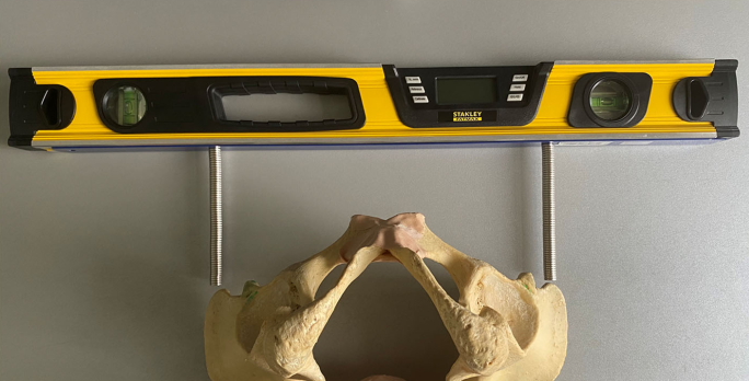 骨盆出口测量器图片