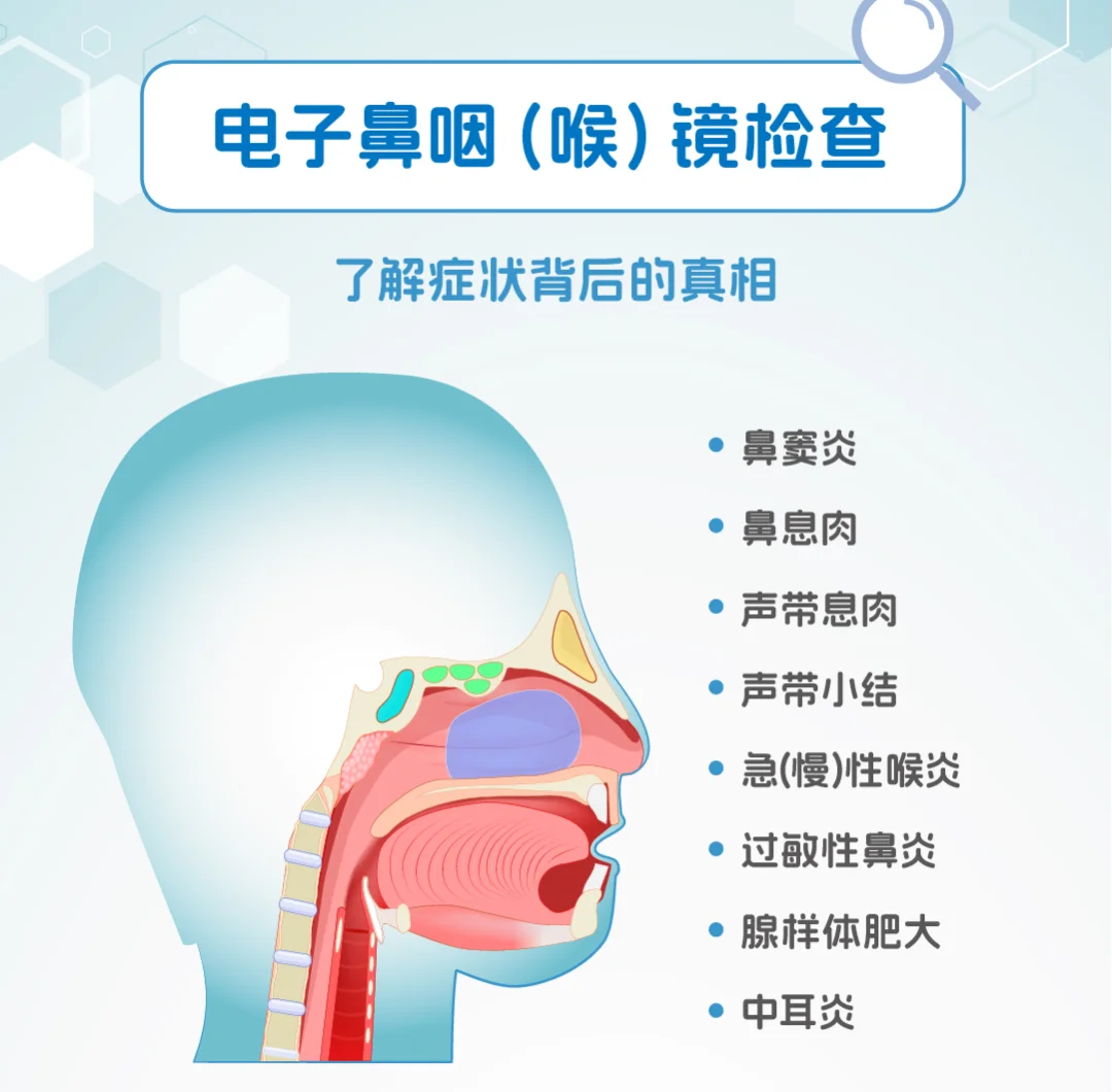 喉镜怎么不能无痛【健康科普】告别“啊”声恐惧！耳鼻喉门诊高清电子鼻咽喉镜，无痛看清您的“咽喉要道”_https://www.jmylbn.com_新闻资讯_第21张