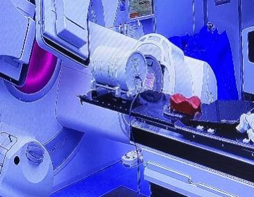 放疗做膜是什么意思精准放疗！八步读懂放疗流程_https://www.jmylbn.com_新闻资讯_第12张