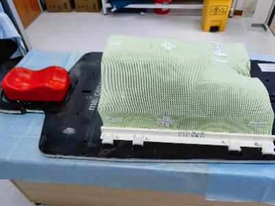 放疗做膜是什么意思精准放疗！八步读懂放疗流程_https://www.jmylbn.com_新闻资讯_第5张