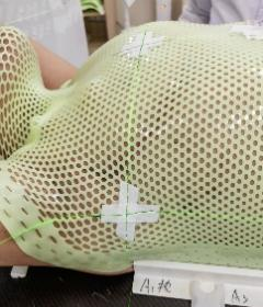 放疗做膜是什么意思精准放疗！八步读懂放疗流程_https://www.jmylbn.com_新闻资讯_第8张