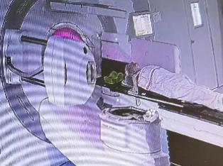 放疗做膜是什么意思精准放疗！八步读懂放疗流程_https://www.jmylbn.com_新闻资讯_第16张