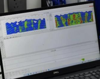 放疗做膜是什么意思精准放疗！八步读懂放疗流程_https://www.jmylbn.com_新闻资讯_第13张
