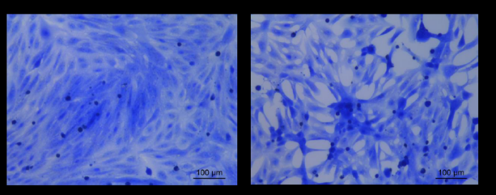 多极射频是什么国产射频美容仪，真的靠谱吗？_https://www.jmylbn.com_新闻资讯_第15张