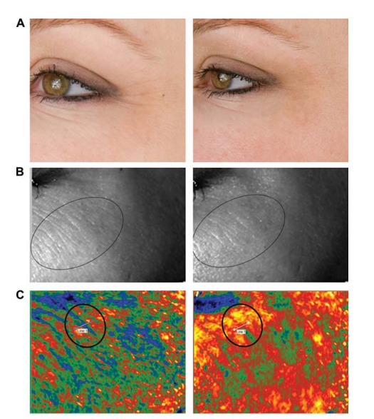 多极射频是什么国产射频美容仪，真的靠谱吗？_https://www.jmylbn.com_新闻资讯_第4张