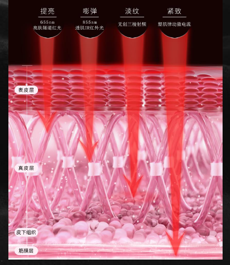 多极射频是什么国产射频美容仪，真的靠谱吗？_https://www.jmylbn.com_新闻资讯_第9张