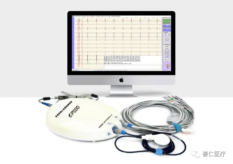 动态心电图怎么分析动态心电图，如何分析和诊断_https://www.jmylbn.com_新闻资讯_第9张