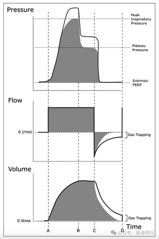 为什么成人呼吸机用容控重症哮喘和AECOPD患者的机械通气初始参数设置及策略_https://www.jmylbn.com_新闻资讯_第11张