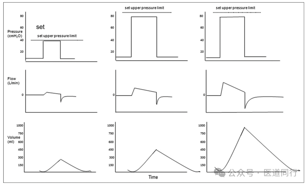 为什么成人呼吸机用容控重症哮喘和AECOPD患者的机械通气初始参数设置及策略_https://www.jmylbn.com_新闻资讯_第6张